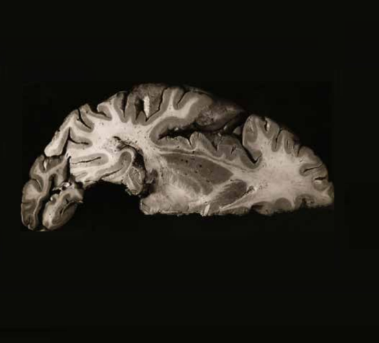 Imagen de corte del cerebro humano